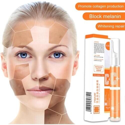 Strong Effect Whitening Cream Freckle Melasma Acne Melanin Spots Face Care Skin Pigment Care Cream E6A8