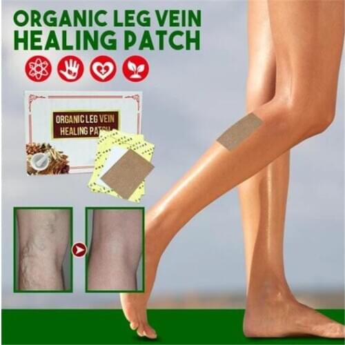 6 Patches Leg Vein Treatment Organic Patch Cure Spider Veins Varicose Treatment Plaster Varicose Veins Vasculitis Patch
