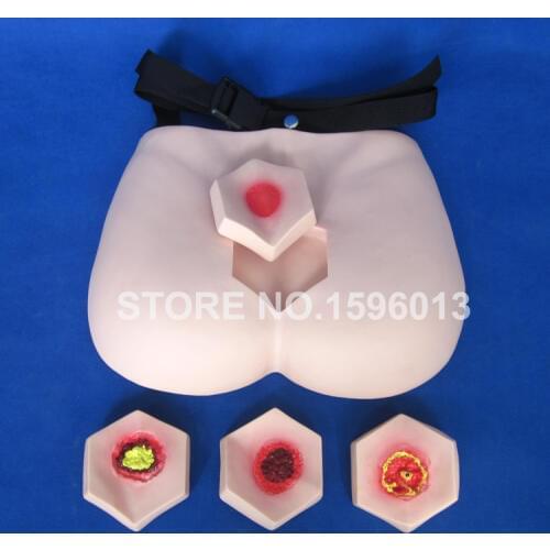 Decubitus Ulcer Stages Care Model Pressure Ulcer Sores Training Simulator