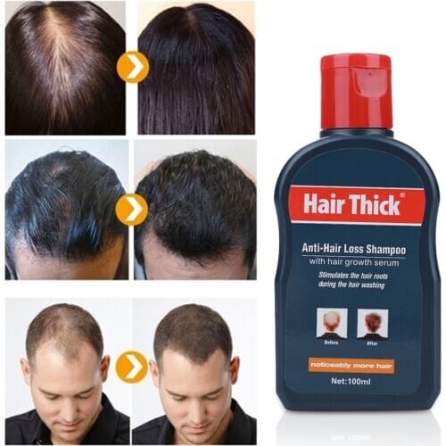 100ml Anti-hair Loss Shampoo Herbal Hair Growth Serum Anti-dandruff Relieve Oil-control Unisex Thin Hair Stimulating Treatment