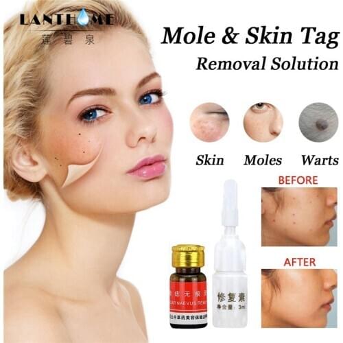 2 Pcs Dark Spot Removal Wart Tag Freckle Removal Oil Mole Skin Painless Essence Beauty Pimple Remover Spot Cleaner Tool
