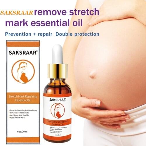 Stretch Marks Remover Essential Oil Skin Care Treatment Cream For Stretch Mark Removal Maternity Slackline For Pregnant Oils