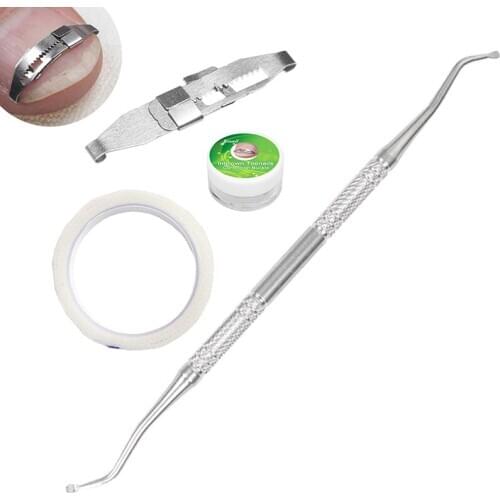 1set Ingrown Toenail Correction Tool Ingrown Toe Nail Treatment Inset Buckle Pressure Sensitive Tape Twillizer Pedicure Tool