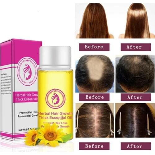 20mL Powerful Hair Growth Care Essence oil 20ml Treatment Anti-Hair Loss products Faster Grow Thick Hairs