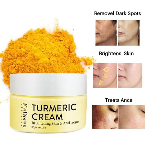 Herb Turmeric Face Cream Repair Acnes scar Dark spot Treatment Moisturizer Whitening Lightening Against Acne skin care 30ml