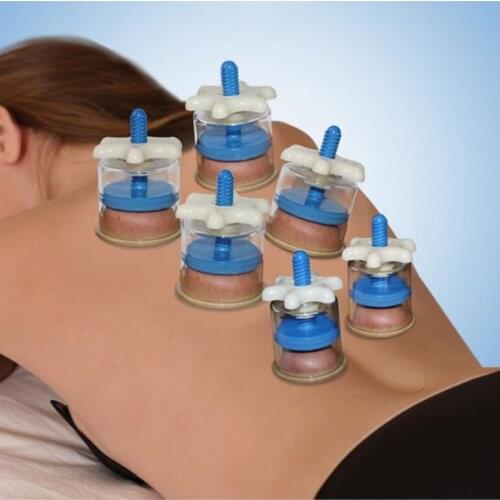 Vacuum cupping household hand screw rotary cupping massage tanks promoting blood circulation to remove blood stasis