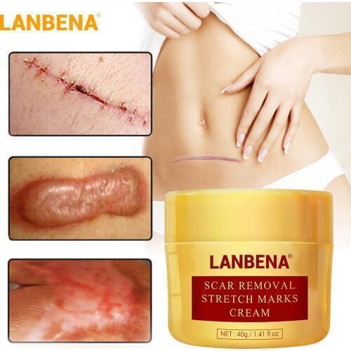 Lanbena Scar Removal Cream Repairing Scar Acne Treatment Blackhead Fade Scar Whitening Moisturizing Skin Care 40g