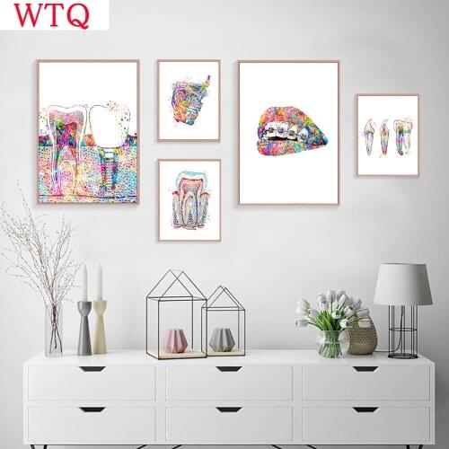Tooth Implant Canvas Wall Painting Dental Art Poster Dentist Anatomy Prints Medical Wall Art Pictures Hospital Clinic Decoration
