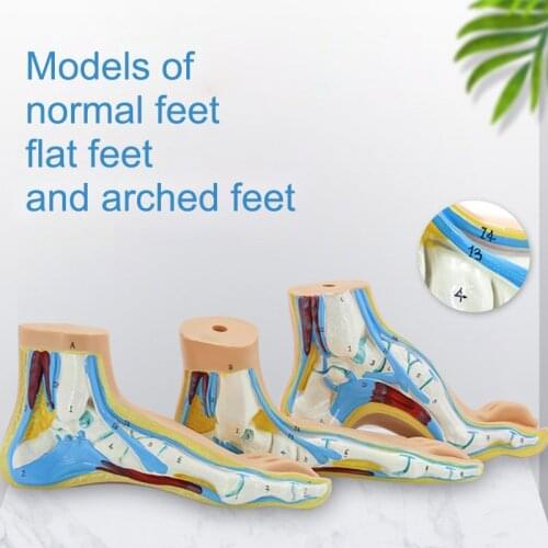 3pcs/set Human Foot Palm Muscle Model Normal Foot Flat Feet Bow Foot Combined Anatomical Model