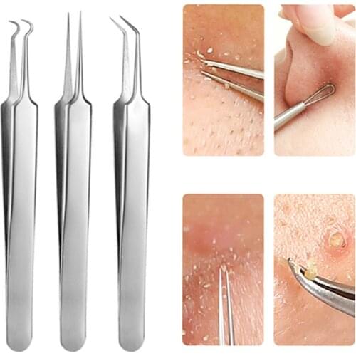 3 Pcs/lot Acne Needle Tweezers Blackhead Blemish Pimples Removal Pointed Bend Gib Head Face Care Tools Comedone Acne Extractor