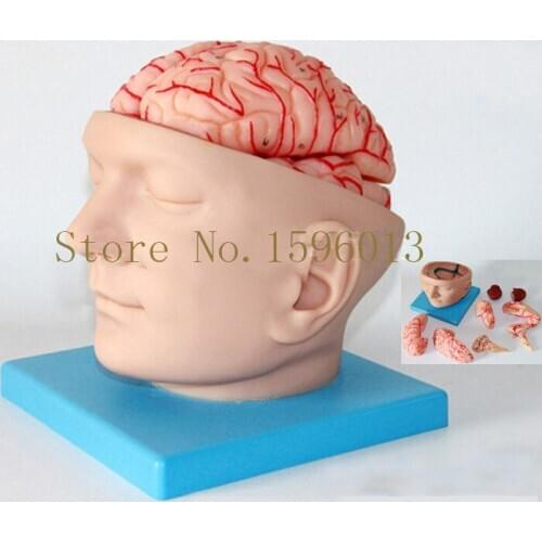 HOT Head with Brain And Brain Artery Model, Head Anatomical Model,Brain with Artery Model