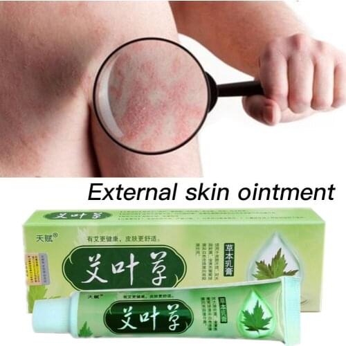 Chinese Traditions Herbal Cream Skin Psoriasis Cream Dermatitis Eczematoid Eczema Ointment Treatment Psoriasis Cream Skin Care