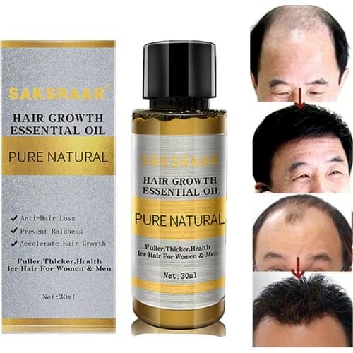 SAKSRAAR Essential Oils For Hair Hair Growth Serum Liquid Care Health Dense Hair Growth Serum 30 Ml Hair Essential Oils