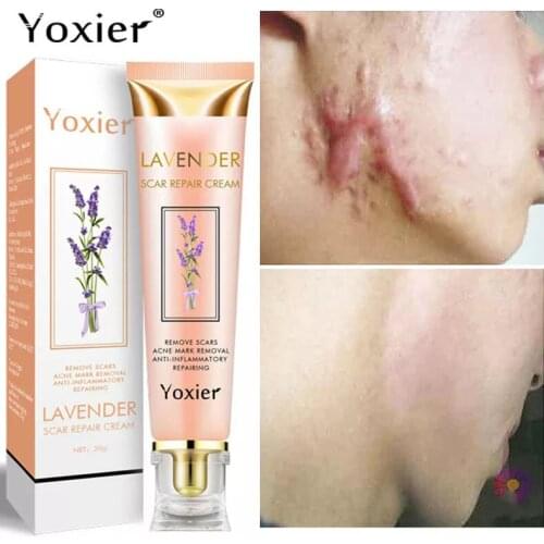Lavender Scar Repair Cream Pimples Stretch Marks Face Gel Removal Pigmentation Corrector Smoothing Whitening Body Skin Care 20g