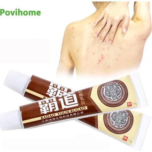 1Pcs 15g Native Herbal Extract Antipruritic Cream Antibacterial Psoriasis Ointment Dermatitis Eczema Psoriasis Skin Care