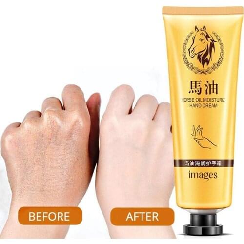 Hand Cream From Crack Foot Repair For Dri Sky Roughness Moistur Winter Palm Snake Peeling Frost Barb Oil Dryness N8G2