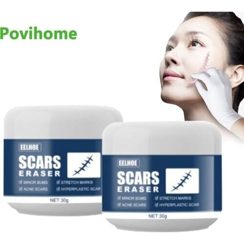 30g Scar Removal Cream Skin Healing Repair Fade Scars Stretch Marks Surgical Scar Burn Skin Repair Remove Wrinkles Moisturizing