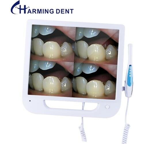 17 Inch Screen Dental Intra Oral Camera with Monitor Digital Intraoral Endoscope Camera CMOS VGA Scanner Medical Equipment Oral