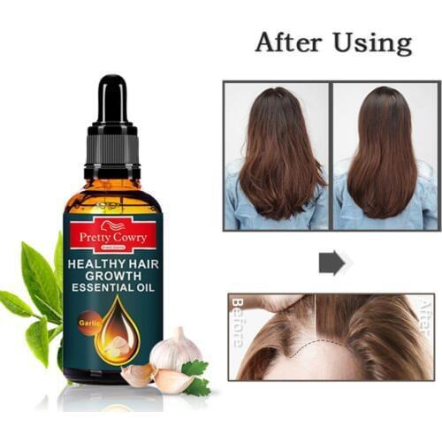 50ml Garlic Hair Growth Oil Anti-Hair Loss Hair Regrowth Herbal Essential Oil Hair Growth Care Products