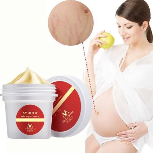 Stretch Marks Remover Body Care Cream Skin Care Treatment Cream For Stretch Mark Removal Maternity Slackline For Pregnant Cream