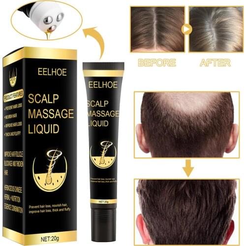 New Hair Scalp Massage Oil 20 Ml Roll On Massager For Hair Loss Damaged Hair Soft And Glossy Growth Essential Oil For Men Women