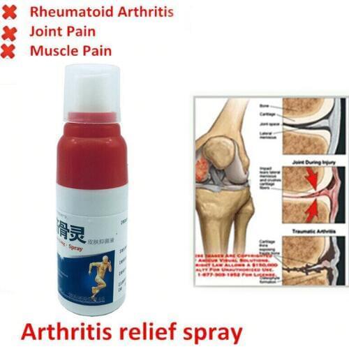 Pain Relief Spray Rheumatism Arthritis Muscle Bone Portable for Sprain Knee Waist SN-Hot
