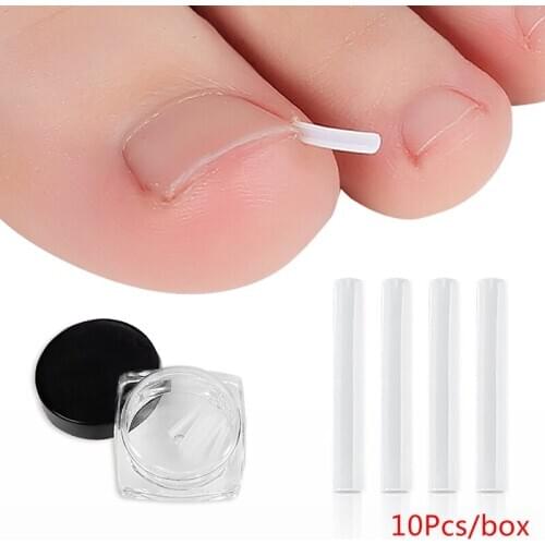 10pcs/pack Toenail Straightening Clip Ingrown Toenail Correction Tool Nail Treatment Elastic Patch Sticker Foot Care Pedicure