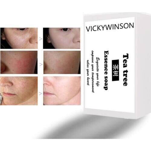 Tea tree essence handmade Soap 50g Cleansing Face Wash Soap Soap for Womens Face and Body Dual Purpose Soap