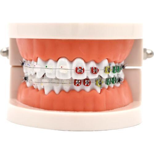 1pc Dental Orthodontic Treatment Model Typodont With Ortho Metal Ceramic Bracket Arch Wire Orthodontic Toothed Denture Model