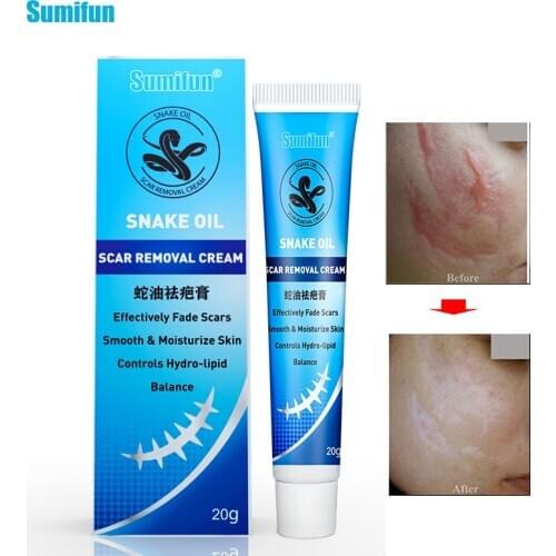 Sumifun Professional 20g Snake Oil Ointment Remove Scar Cream Acne Treatment Hand Skin Face Care Natural Chinese Medical K10016