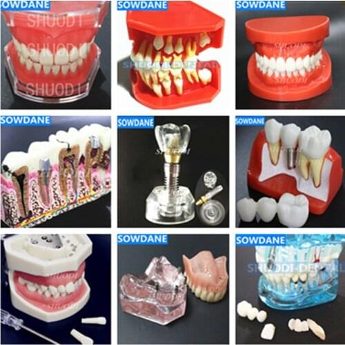 Dental Study Teaching Model Dental Impant Standard Model Removable Teeth ADULT Child TYPODONT Model Dentist Communication Model