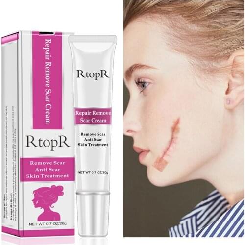 RtopR Acne Scar Stretch Marks Remove Cream Skin Repair Face Cream Acne Spot Treatment Blackhead Whitening Cream Skin Care