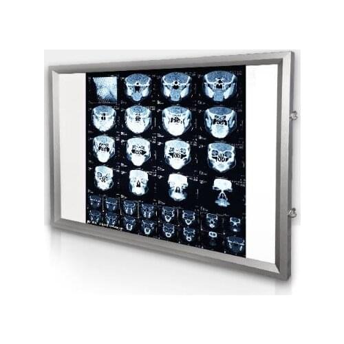 100-240V Hospital X-ray viewing lamp Dental orthopaedic Touch control X-Ray Film Illuminator Light Box X-ray Viewer