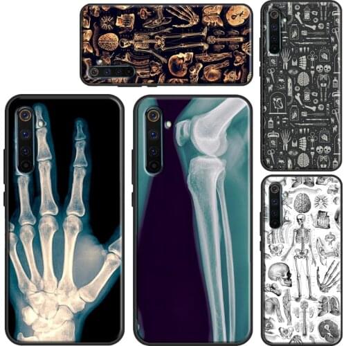 X-Ray Human Anatomy Case For OPPO Realme 8 Pro 6 7 Q3 Pro C3 C11 C15 C21 GT OnePlus 8 Pro 9 Pro 7T 8T 9R Cover