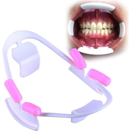 5pcs Dental Mouth Opener 3D Oral Cheek Lip Retractor Intraoral Prop Orthodontic Tool Fit for Adult and Child 3D mouthpiece