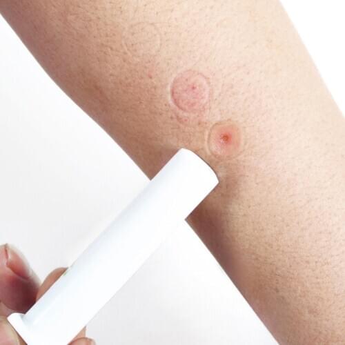 Mosquito Electric Extractor Pump First Aid Safety Kit Snake and Bug Bites Safety Emergency Photocatalytic Effective Light #A