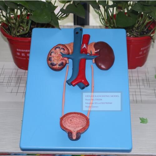 ISO Urinary System Model,Our Bodys Urinary System Model Of the Organ,Urinary Tract Anatomic Model
