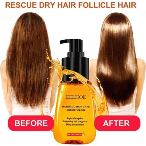 1pcs Herbal Essential Oil Improve The Hair Dryness Hair Hair Repair Prevent Care Loss Nourishment Prevent Product Loss Dama T5P7