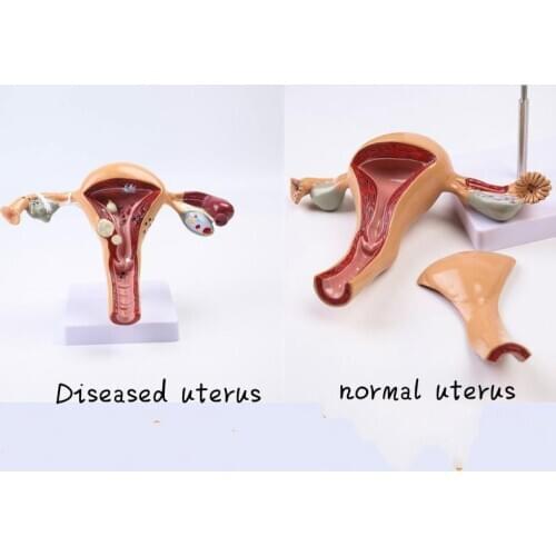 Female Anatomy Reproductive Uterus Model Vaginal Ovary Model Teaching Mold Disease Change Science Teaching Aids Biology