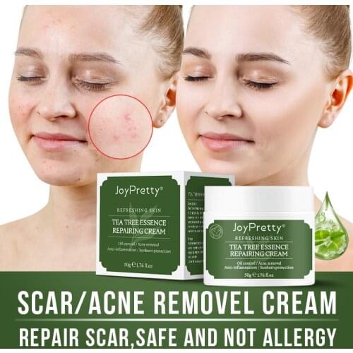 JoyPretty Tea Tree Acne Treatment Cream Improve Blackhead Rough Pores Pimple Acne Scar Removal Acne Skin Repair Skin Care