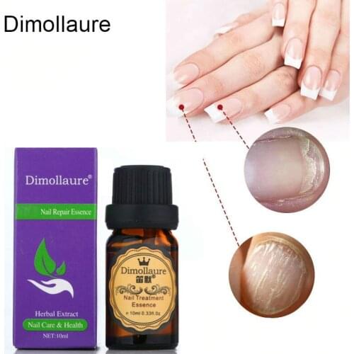 Dimollaure Fungal Nail Treatment Feet Care Essence Nail Foot smooth Toe Nail Fungus Removal Gel Anti Infection Gel Onychomycosis