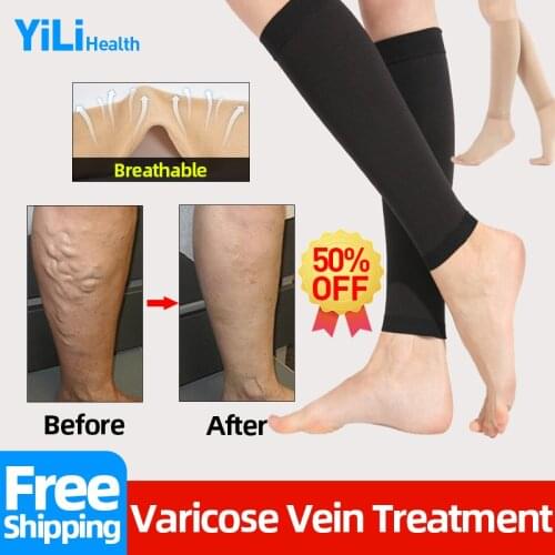 Varicose Veins Tights Socks Prevent Vasculitis Inflammation Phlebitis Legs Calf Varicosity Compression Stockings