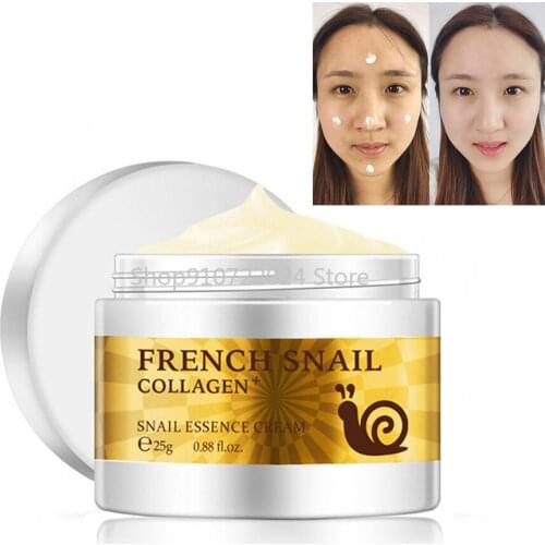 LAIKOU Brand Snail Face Cream Acne Scar Removal cream For Face Skin Care Whitening Cream Snail Stretch Marks Nourishing For Face