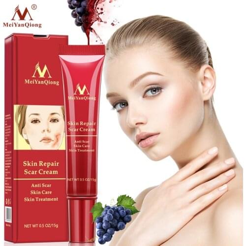 MeiYanQiong Repair Scar Cream Acne Spots Pigmentation Corrector Whitening Cream Anti Scar Stretch Marks Repair Gel