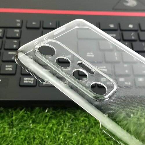 For Xiaomi 10S Redmi Note 10 4G Case Crystal Hard PC Full Cover Clear Camera Protect Back Shell