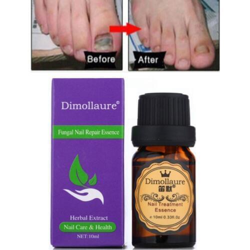3pcs Dimollaure Fungal Nail Treatment Essence Hand Foot Toe Nail Fungus Removal Gel Anti Infection Gel Onychomycosis feet care