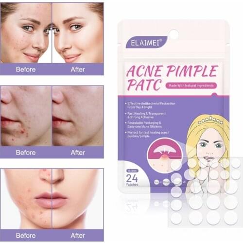24PCS Acne Remover Treatment Cream Blackhead Remover Mask Acne Remover Black Pimple Scar Skin Tag Removal Waterproof Acne Patch