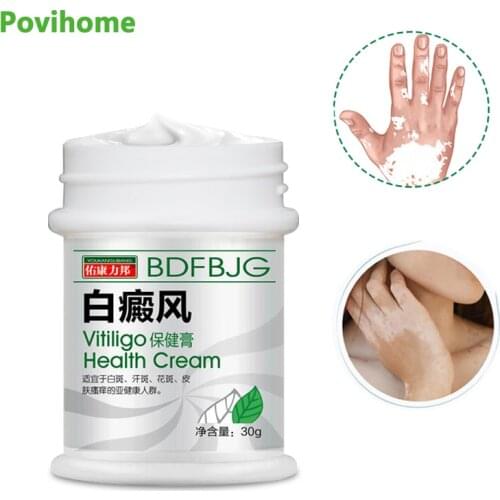 1Pcs 30g White Spot Vitiligo Treament Cream Leukoplakia Disease Repair Antibacterial Ointment Body Skin Care Medical Plaster