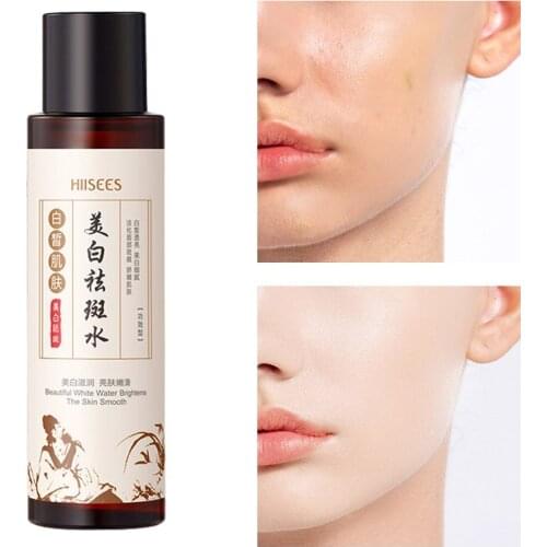 Whitening Anti-Freckle Toner 120ML Brightening Moisturizing Anti Dry Repair Face Skin Care Nicotinamide Tonic Remove Melasma P