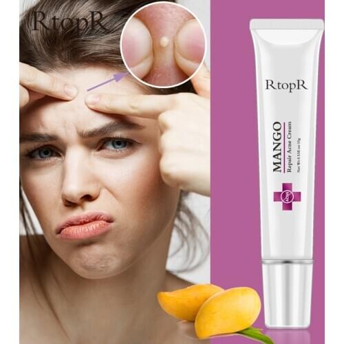 RtopR 15g Mango Repair Acne Cream Patches Natural Acne Treatment Blackhead Scar Removal Cream Shrink Pores Moisturizing Skincare